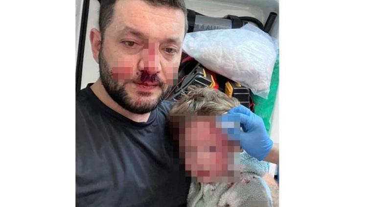 BABANIN BURNUNDA KIRIK, İKRA BEBEĞİN KAFATASINDA ÇATLAK VAR