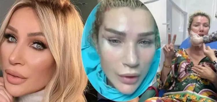 Seda Sayan son görüntüsüyle gündem oldu Filtre mi estetik mi