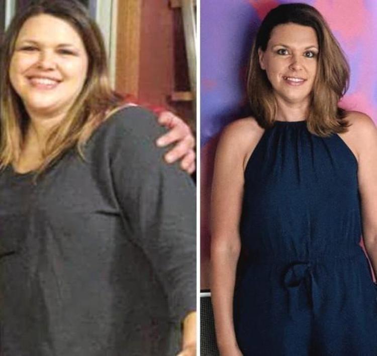111 kilodaki kadın tam 45 kilo birden verdi 5 adımı açıkladı: Meğer mum gibi erimenin sırrı bu kadar basitmiş...