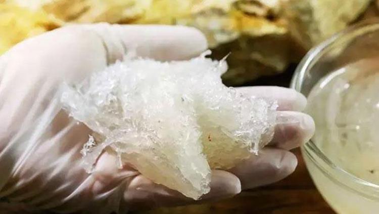 Saç dibindeki egzama ve kepeğin kökünü kazıyor Saça döküp 5 dakika masaj yapmak yetiyor