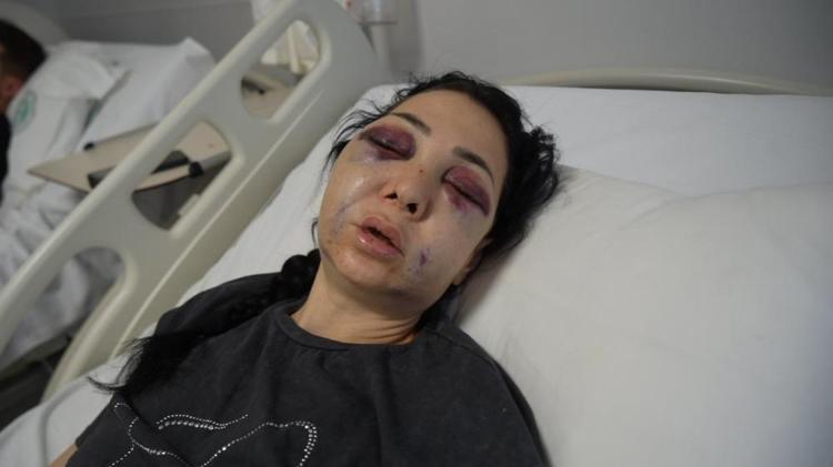 Bayram günü ‘küfür’ dehşeti Anne ve oğluna meydan dayağı