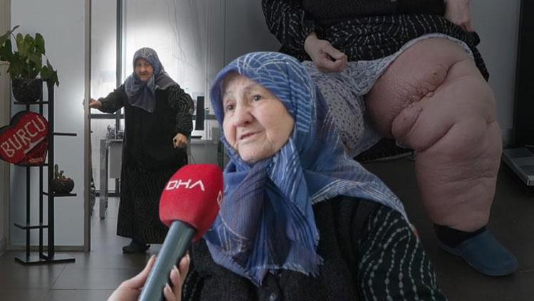 Fil hastası Hava teyzenin yardım çağrısı duyuldu: 2 haftada ayağa kalktı Müsaade edemezdik