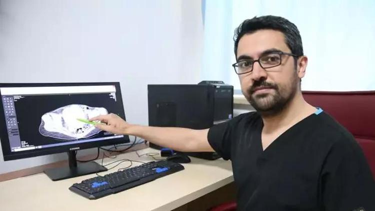 Yıllarca enfeksiyon denildi, gerçek başka çıktı Doktorları bile şaşkına çevirdi