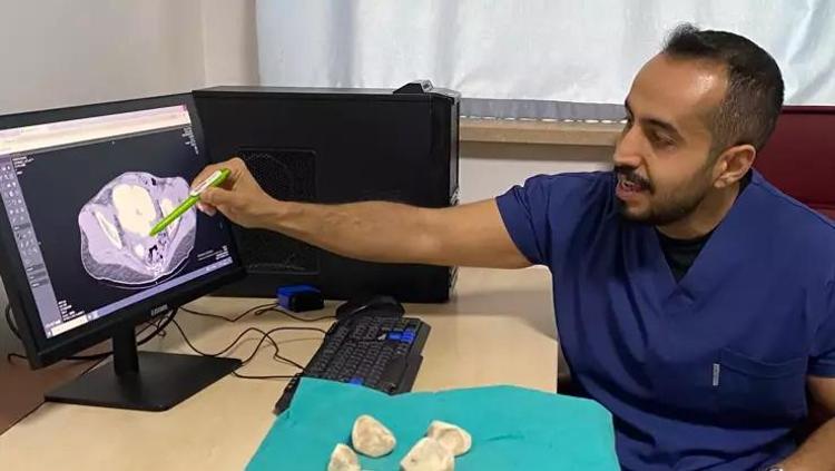 Yıllarca enfeksiyon denildi, gerçek başka çıktı Doktorları bile şaşkına çevirdi