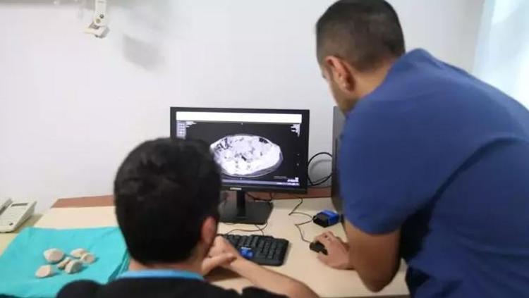 Yıllarca enfeksiyon denildi, gerçek başka çıktı Doktorları bile şaşkına çevirdi