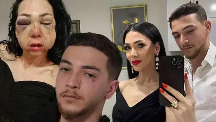 Bayram kabusunda son perde Darbedilen annenin feryadı: Saçlarım kazındı, mama ile besleniyorum