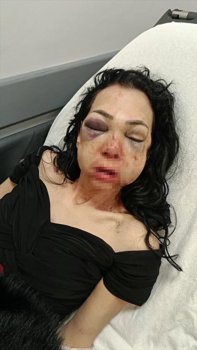Bayram kabusunda son perde Darbedilen annenin feryadı: Saçlarım kazındı, mama ile besleniyorum