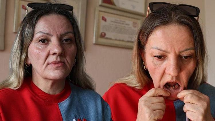 Diş tedavisi değil, hayat karartan skandal 25 dişi birden çekildi