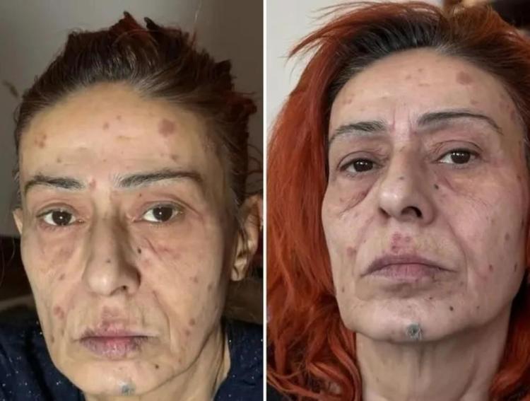 Yıldız Tilbeden sosyal medya kararı Paylaşım düzenini değiştirdi