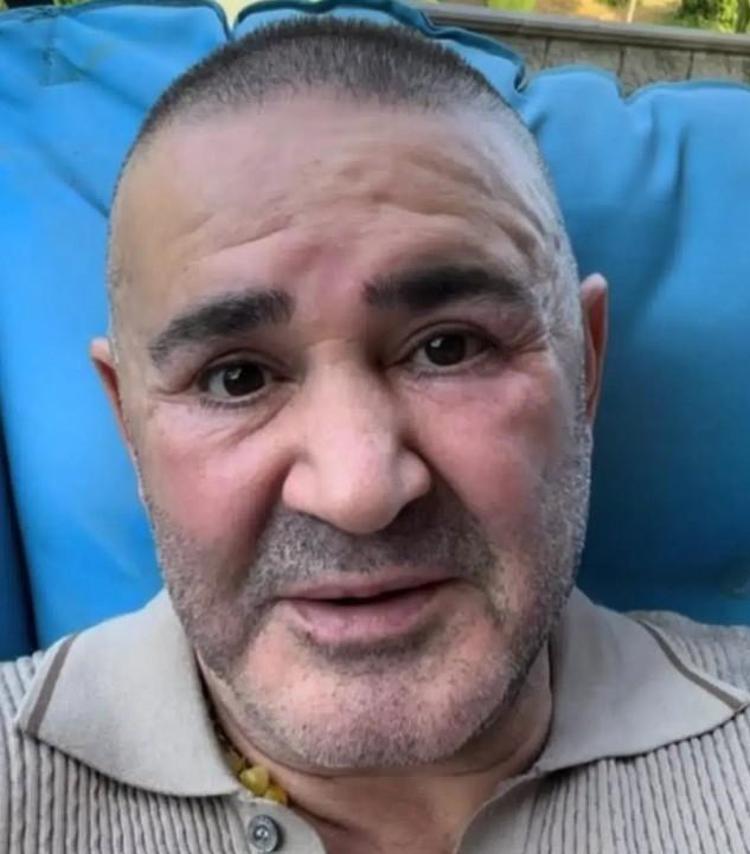 Şafak Sezer sosyal medyanın diline düştü Botokslu hali Pınar Altuğa benzetildi