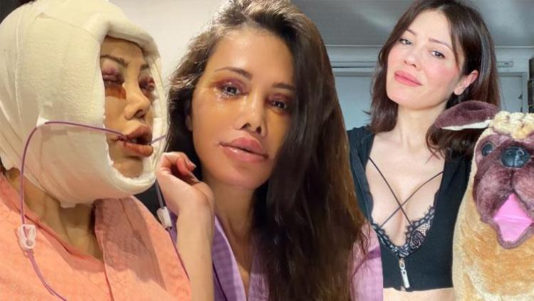 Korede yüz nakli olmuştu Didem Ceranın son haline beğeni yağdı