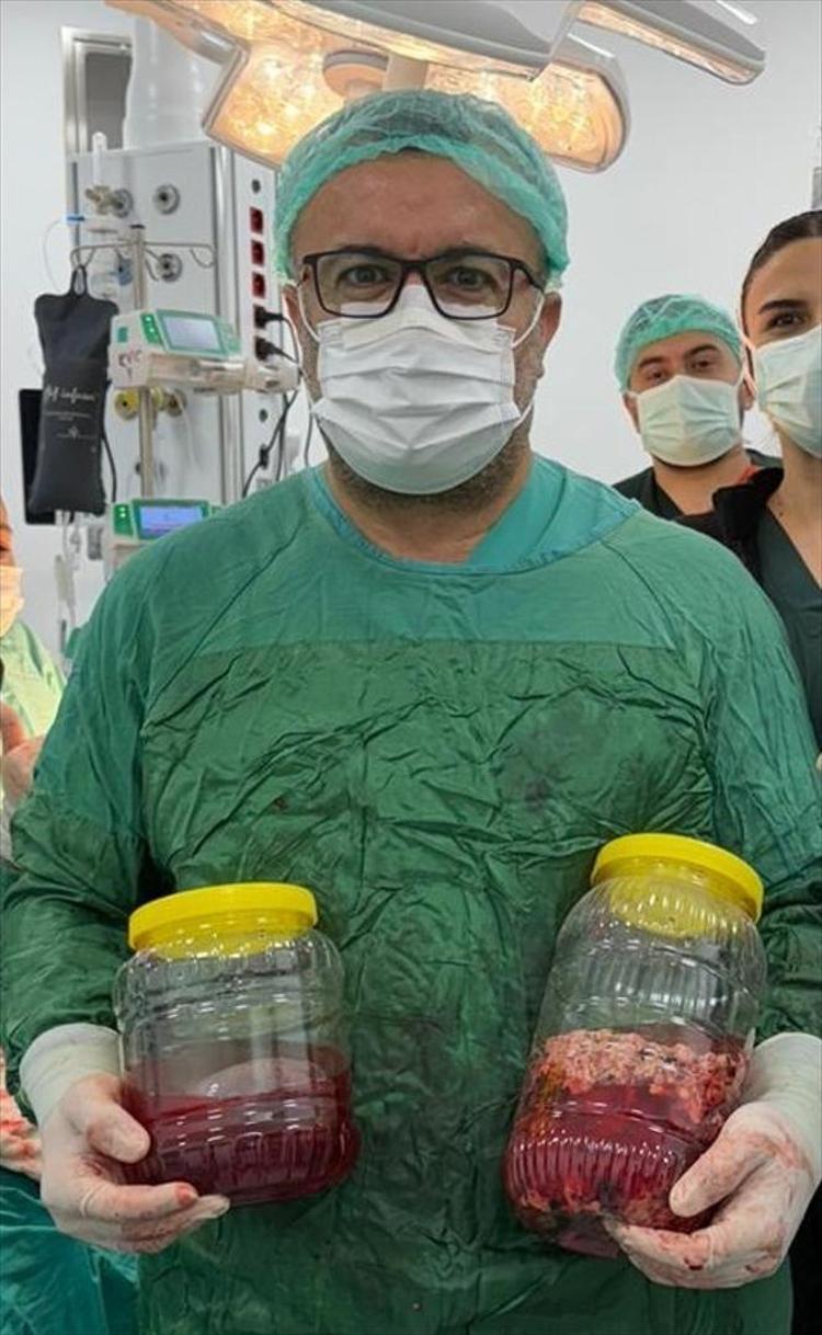 Kilo verdiğini zannediyordu hayatının şokunu yaşadı Gerçek hastanede ortaya çıktı