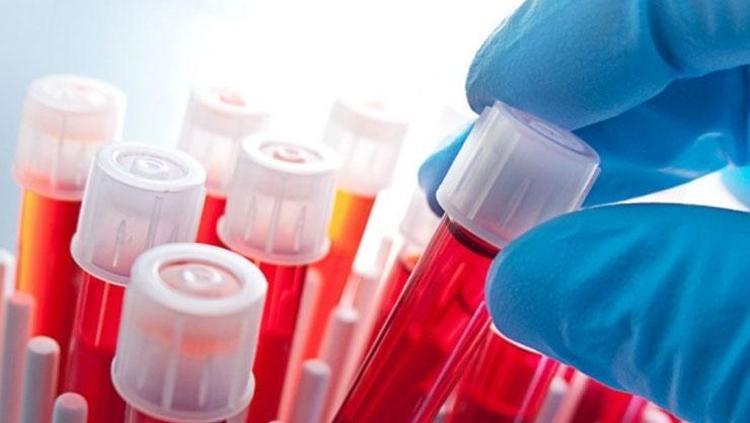 Böbrek ve kalp hastalıkları yıllar öncesinden tespit edebilir Yeni test tıp dünyasında yankı uyandırdı