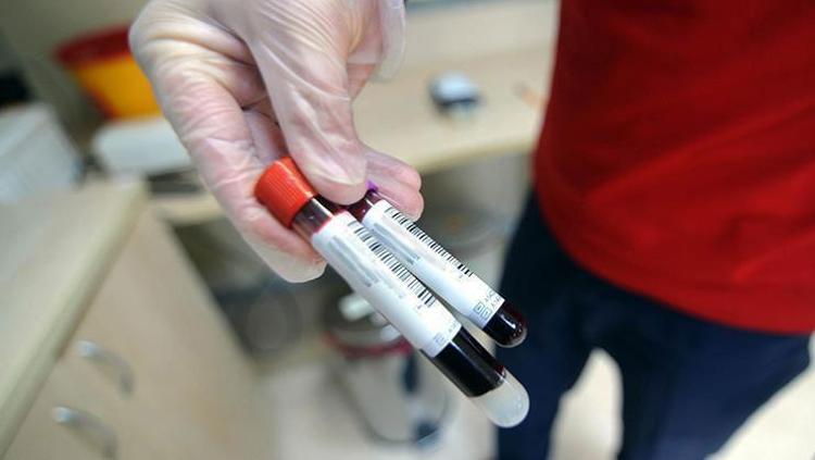 Böbrek ve kalp hastalıkları yıllar öncesinden tespit edebilir Yeni test tıp dünyasında yankı uyandırdı