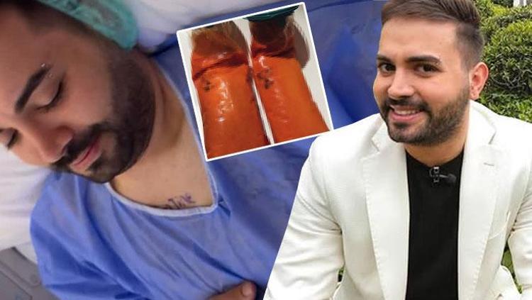 Kadir Ezildi ameliyat oldu Vücudundan çıkanlar şoke etti