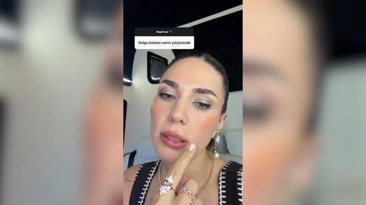 Görünmez kaza diyerek paylaştı Buse Varola nazar değdi