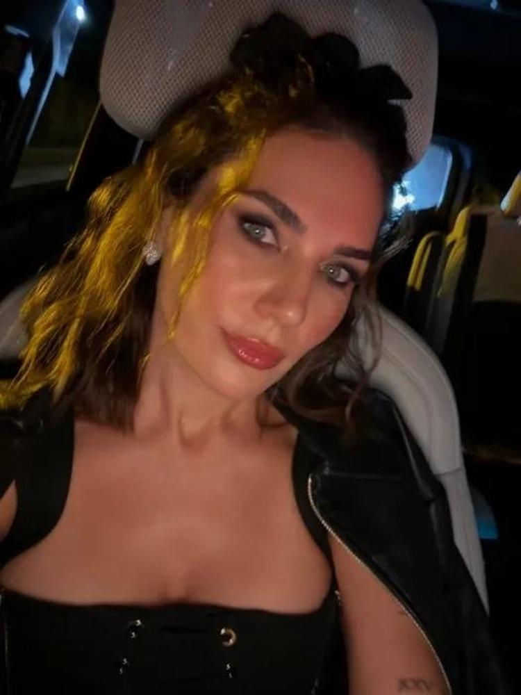 ESTETİK AÇIKLAMASIYLA GÜNDEME GELMİŞTİ