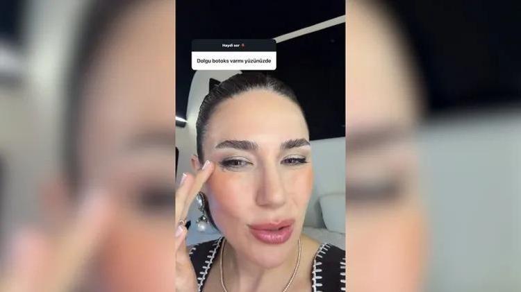 Görünmez kaza diyerek paylaştı Buse Varola nazar değdi