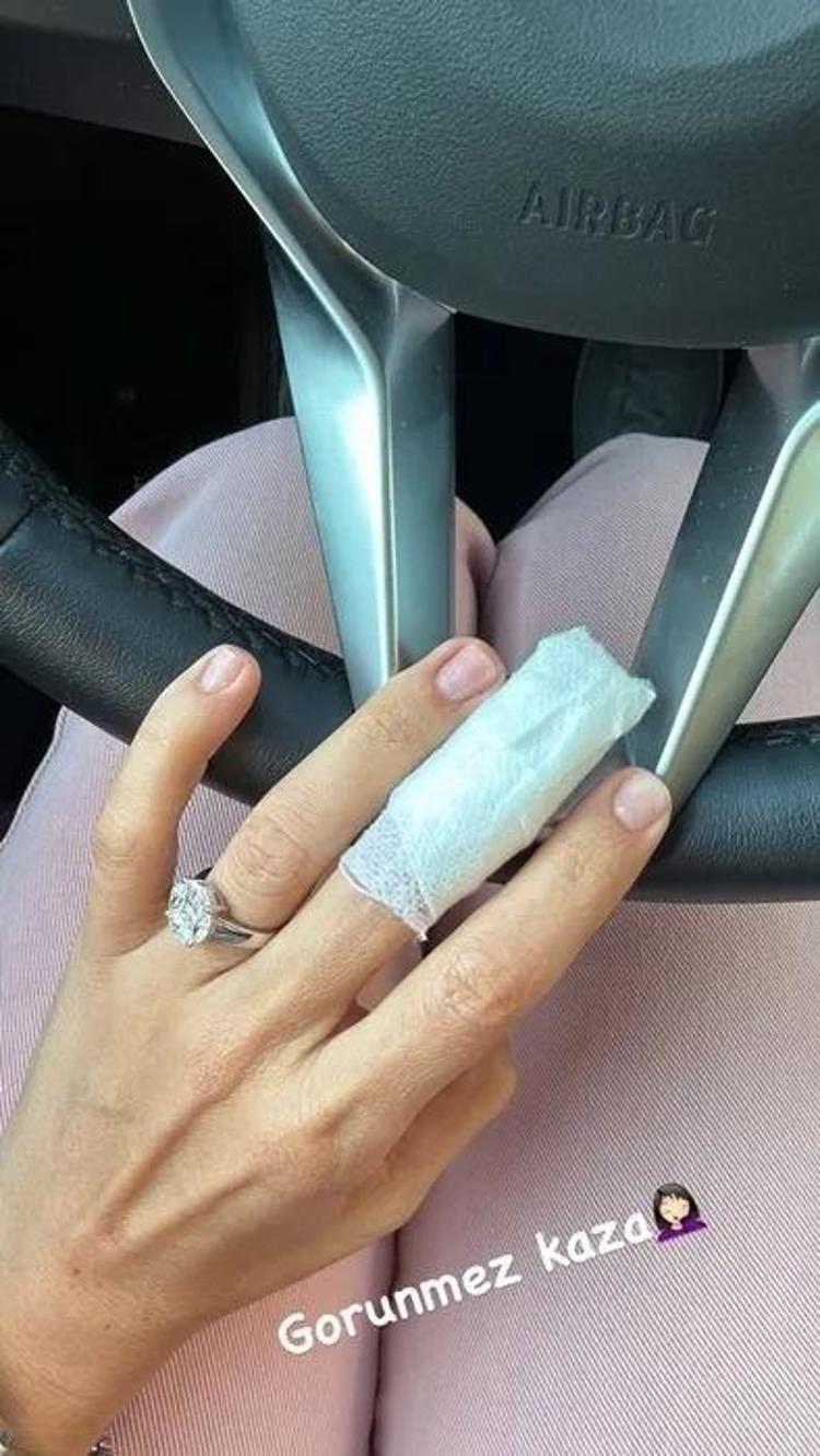 Görünmez kaza diyerek paylaştı Buse Varola nazar değdi