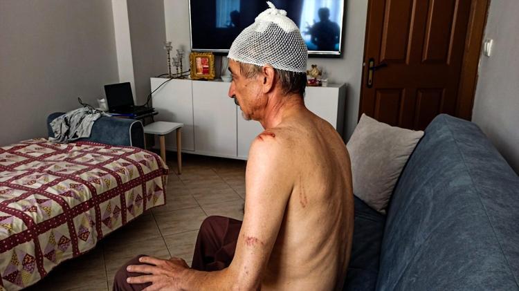 Sokakta çay içerken dehşeti yaşadı Kafasına 11 dikiş atıldı