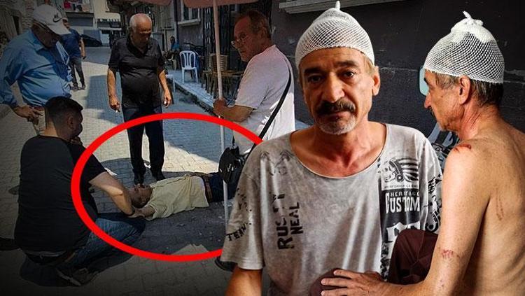 Sokakta çay içerken dehşeti yaşadı Kafasına 11 dikiş atıldı