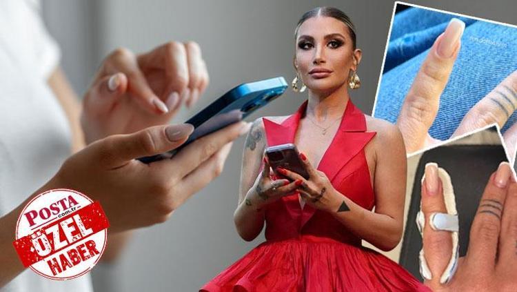 İrem Dericinin parmağı yamuldu, sebebi ortaya çıktı Uzman isim uyardı: Vücudunuz size Lütfen biraz dur diyordur