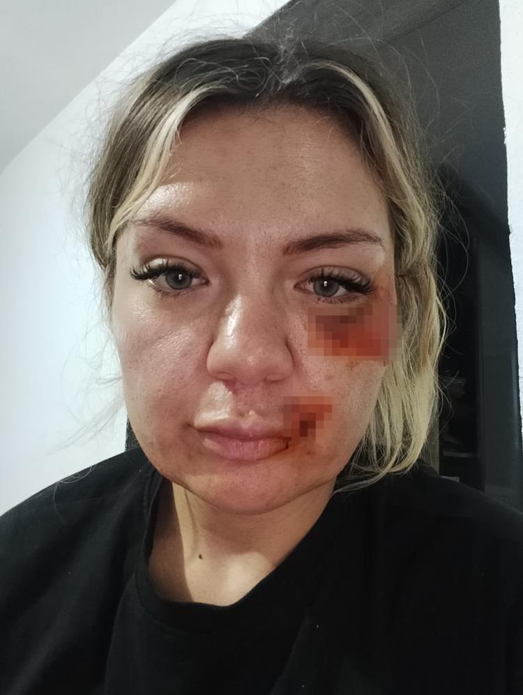 YAKLAŞIK 30 BIÇAK DARBESİ VAR