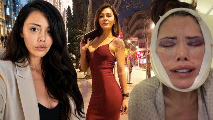 Yüz nakli sonrası yine ameliyat olan Didem Ceran ağlayarak isyan etti Hakkım helal değil
