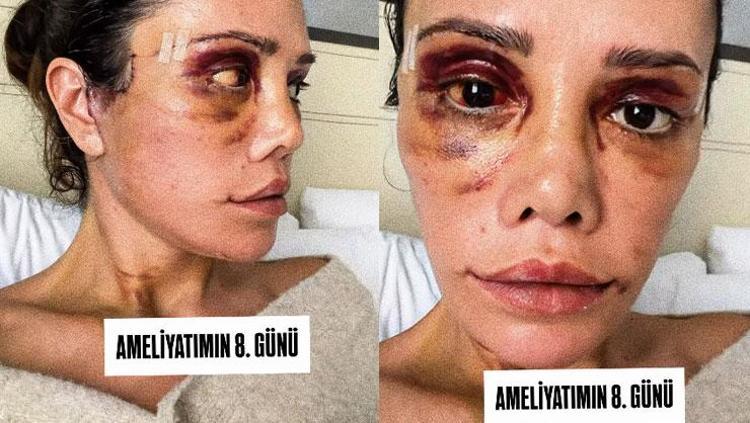 ACIMASIZ YORUMLARDAN UZAK KALMAMI İSTEDİLER