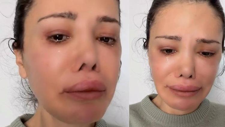 KEMİKLER KESİLDİ, ÇIKAN TOZ DOLGU OLARAK KULLANILDI