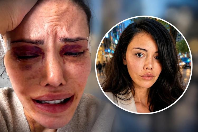 Yüz nakli olmuştu Didem Ceran: Beni CİMERe şikayet ediyorlar