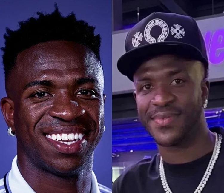 Real Madrid’in yıldızı Vinícius Júnior estetik operasyonla yüzünü değiştirdi