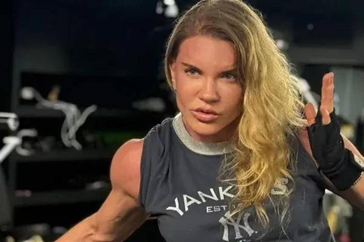 Mazhar Alansonun eşi Biricik Suden bu kez fiziğiyle değil estetik işlemiyle gündemde
