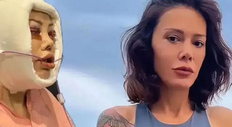 İki kez yüzünü gerdiren Didem Cerandan estetik açıklaması Kim Kardashian yöntemleri uygulanacak