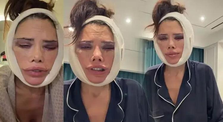 İki kez yüzünü gerdiren Didem Cerandan estetik açıklaması Kim Kardashian yöntemleri uygulanacak