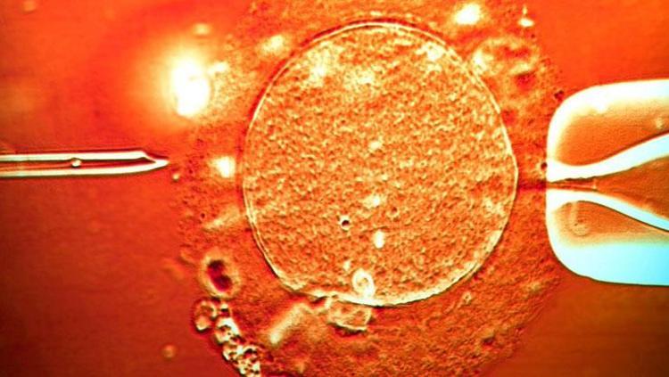 Tüp bebek skandalında yanlış donör şüphesi Vaka sayısı 30 oldu