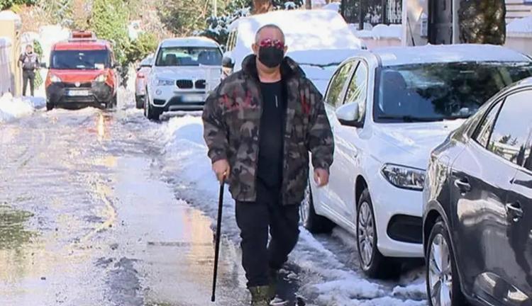 YILLARDIR BASTON KULLANIYOR