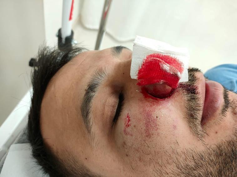 Türkiye Konyadaki dehşeti konuşurken bir sağlık çalışanına daha saldırı