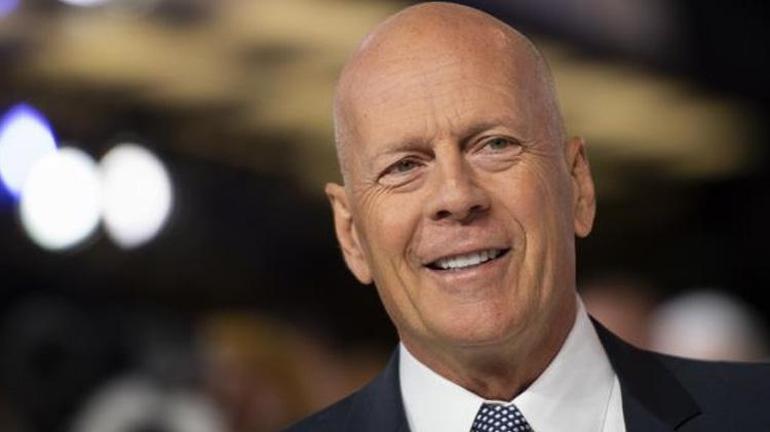 Afazi nedir Belirtileri neler, tedavisi var mı Bruce Willis afazi hastalığına yakalandı