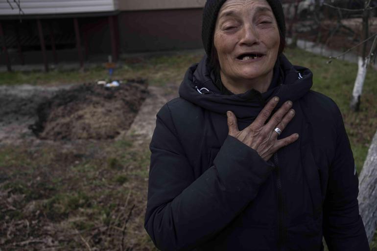 Rusların masum kurbanları: Derisine Nazi sembolü dağladılar