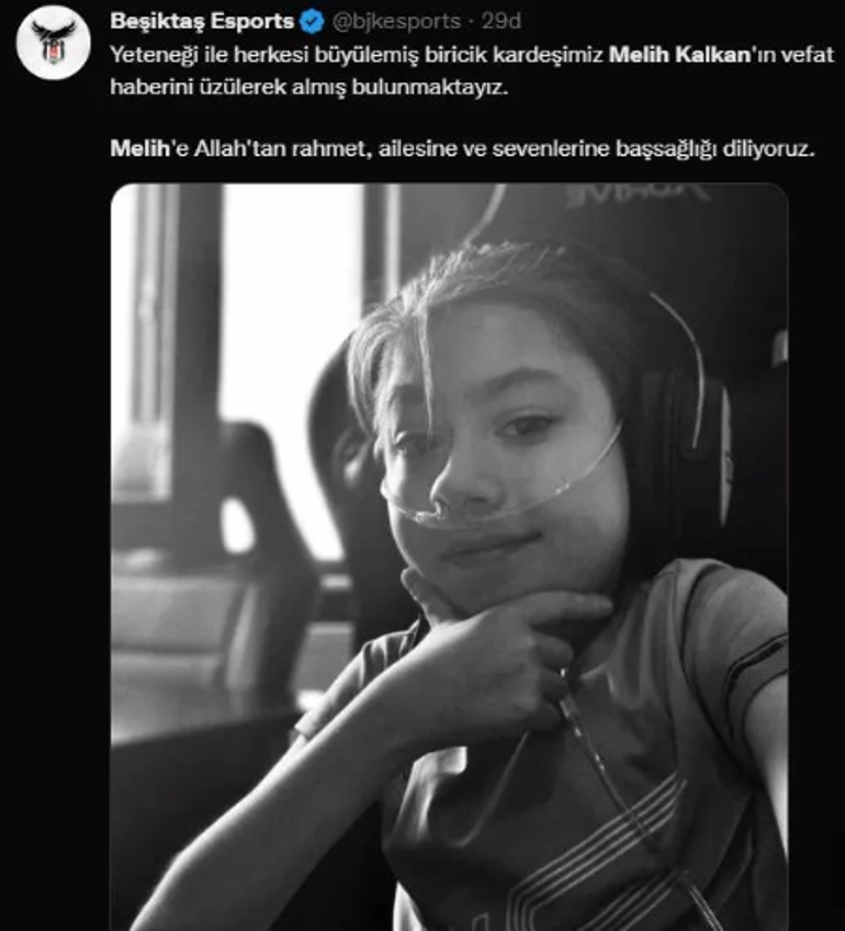 Melih Kalkan neden öldü, kaç yaşındaydı Twitch yayıncısı Melih Kalkan’ın hastalığı kistik fibrozis nedir