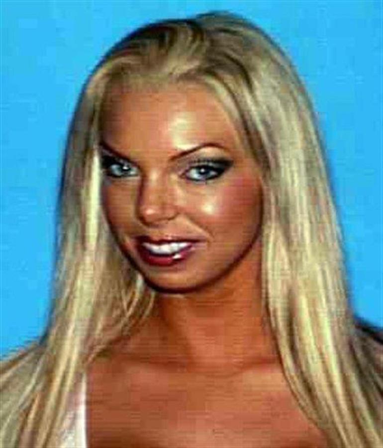 Playboy güzelinin korkunç ölümü: Göğüs implantları davanın çözülmesini sağladı