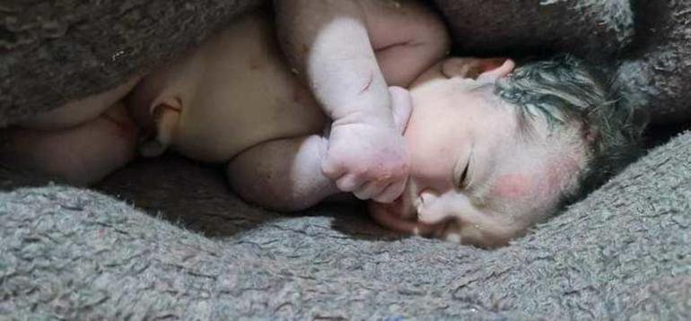 Enkaz altında dünyaya gelmişti... Suriyedeki bebekten haber var