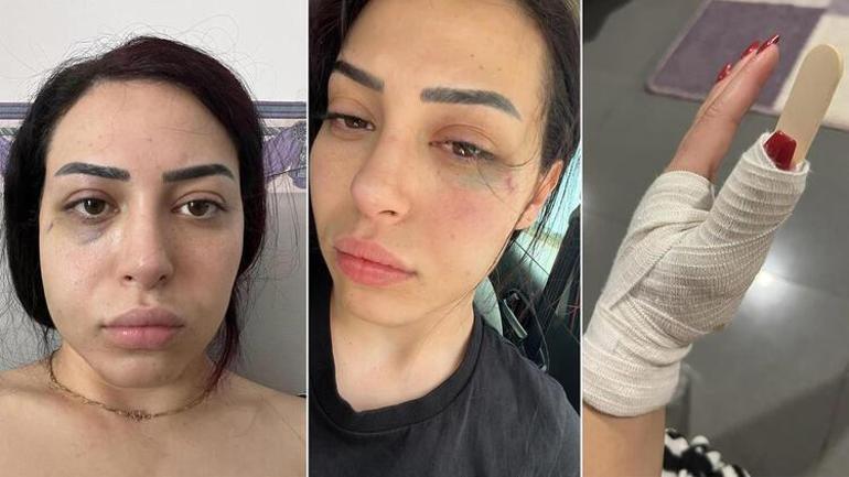GKRYde Türk kızına saldırı Görüntüler ortaya çıktı