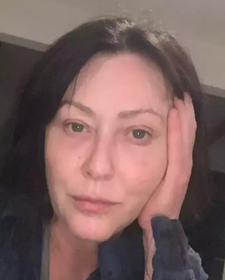 Shannen Doherty üzücü haberi duyurdu: Kanser beynime yayıldı