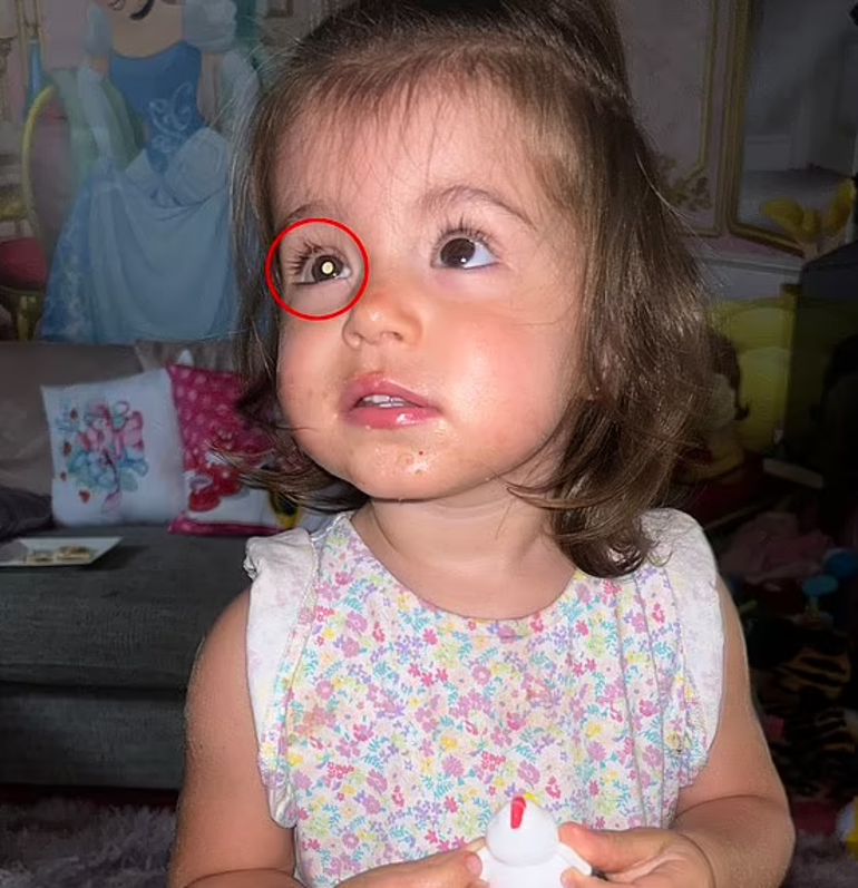 18 aylık kızının gözündeki halkayı görünce hemen doktora koştu, gerçeği öğrenince dünyası başına yıkıldı