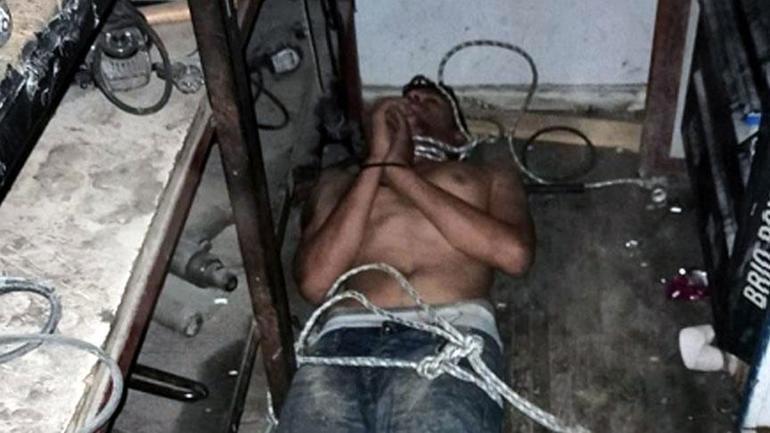 Dişleri kırılıp, hamam böceği yedirildi 3 günlük işkencede şok rapor
