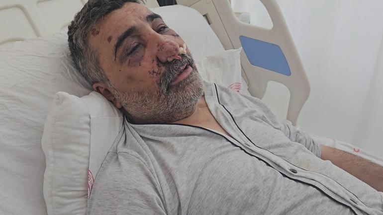 İngiliz boksörün dehşeti yaşattığı taksici konuştu ‘Isırmaya, öpmeye başladı’