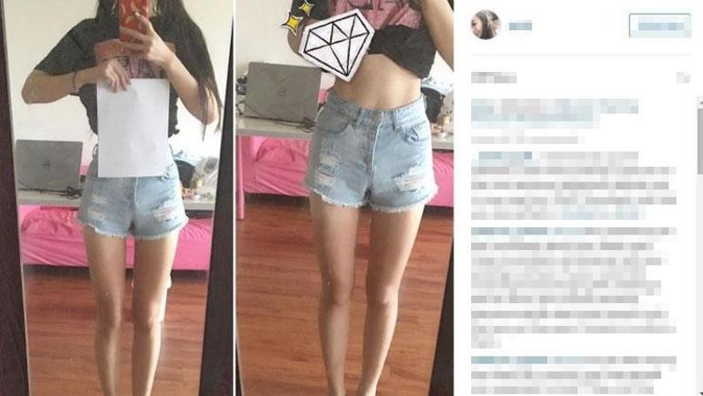 Sosyal medyanın yeni tuzağı Tehlikeli zayıflama trendi: İğne ipliğe dönüyorlar ama sağlığı bozuyor