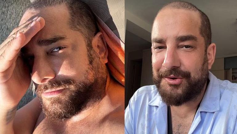 Enis Arıkan protez saçını çıkardı Son hali dikkat çekti